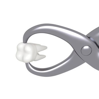 Après une extraction, ou une intervention chirurgicale